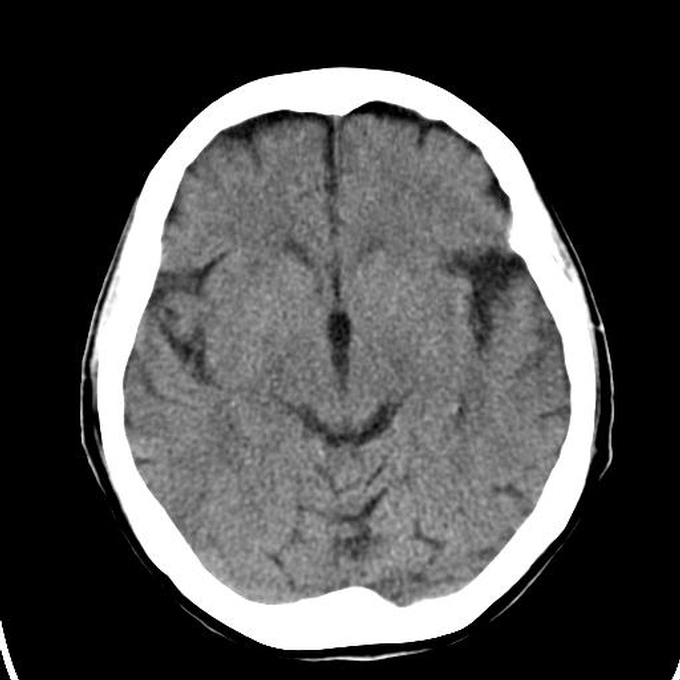 Series: 20050503103649