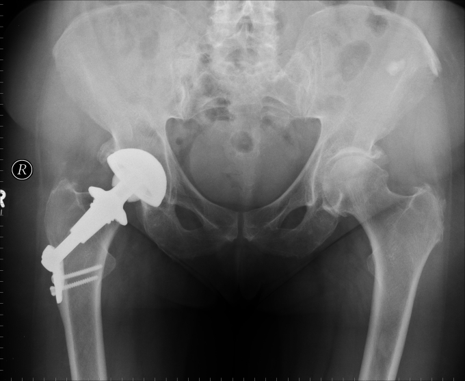 Series: 20051126140839