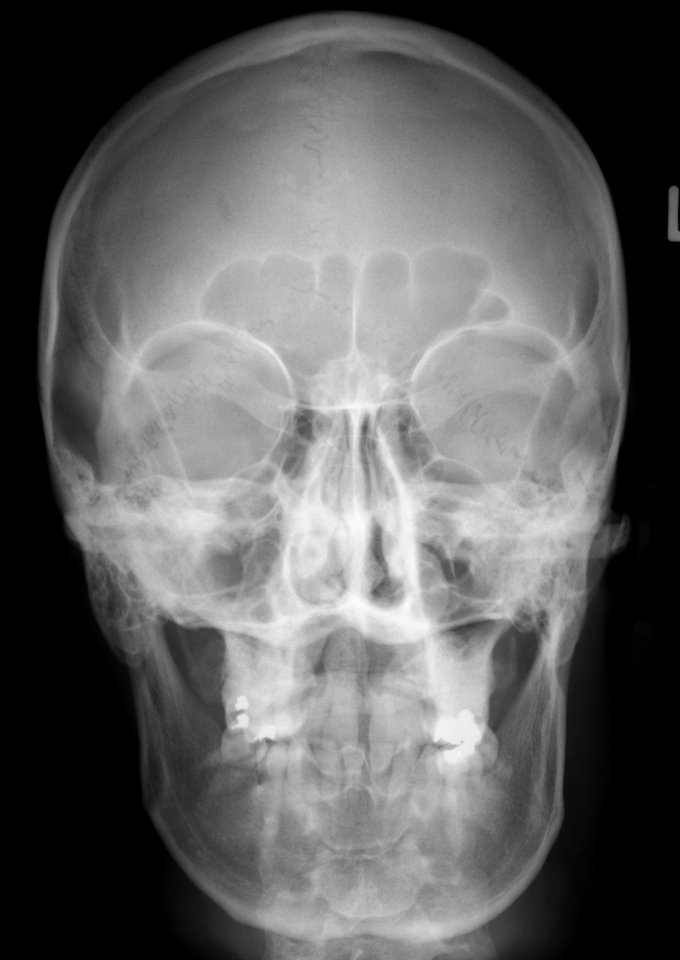 Series: 20070526102628